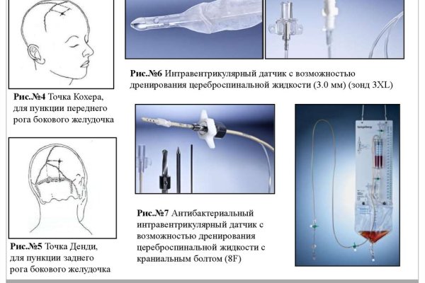 Ссылка блэкспрут годнотаба